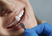 Mostiček ali zobni vsadek? Mostiček ali zobni vsadek oziroma implantat?