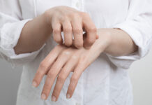 Zima in suha koža: kako si pomagati Suha koža